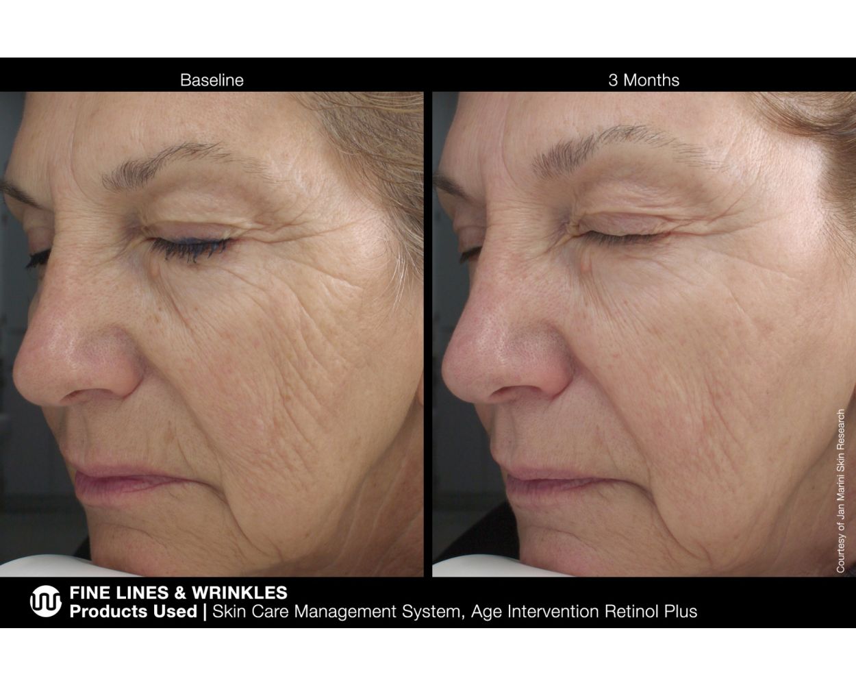 Крем Age Intervention® Retinol Plus