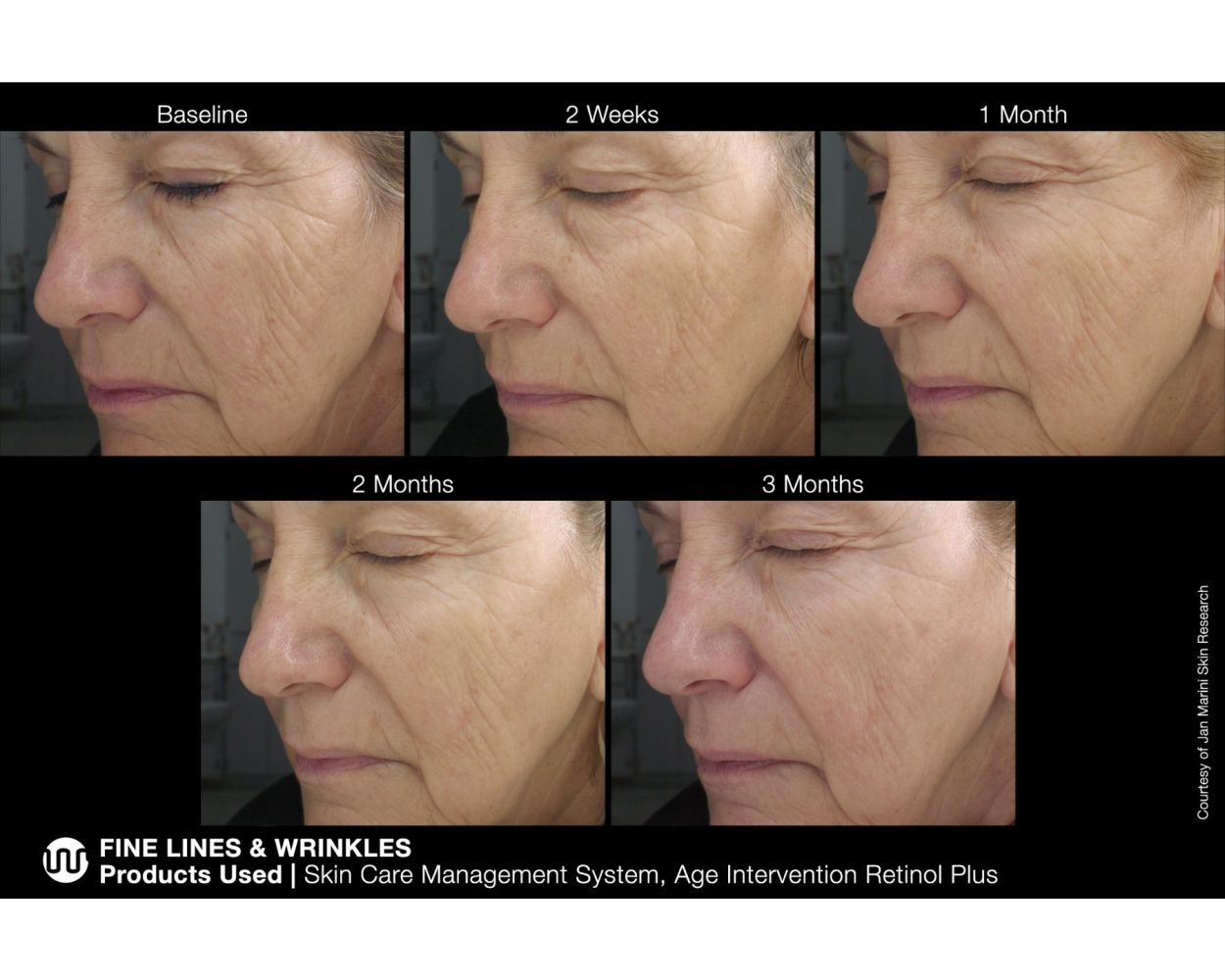 Крем Age Intervention® Retinol Plus