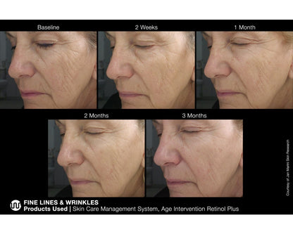 Крем Age Intervention® Retinol Plus